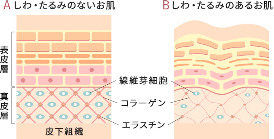 肌のハリや弾力の低下