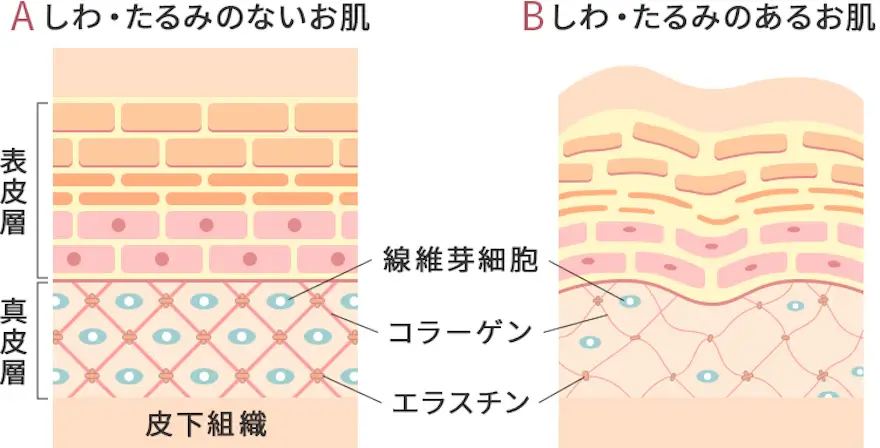 しわができるメカニズム